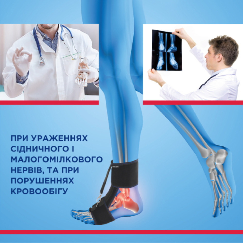 Бандаж для гомілковостопного суглоба з ефектом «звисаючої стопи» Торос Тип 417
