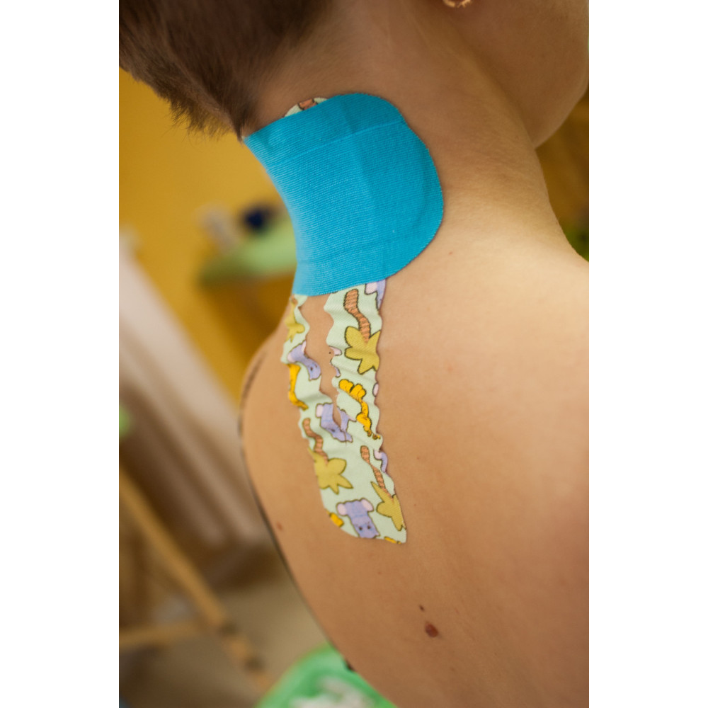 Кінезіотейп Epos Tape 5 см х 5 м (Блакитний)