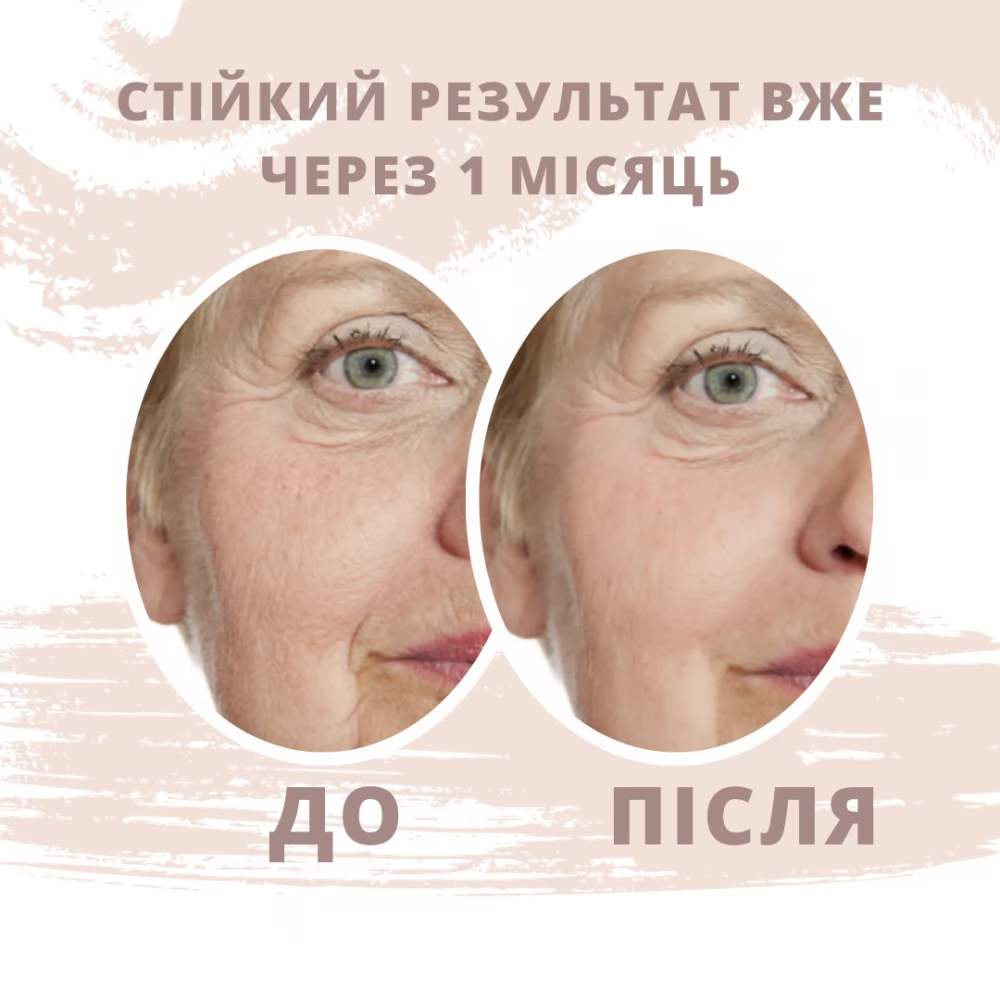 Кінезіотейп для обличчя Kindmax Face Tape 5 см х 5 м (Бежевий)
