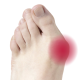 Гелевий протектор на великий палець Vitamed 5th Toe Gel Bunion Pad
