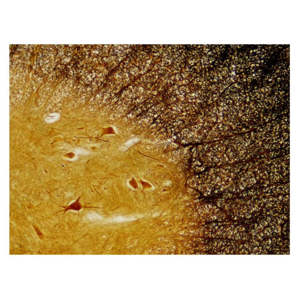 Набір мікропрепаратів Bresser Histology 30 шт (5985000)