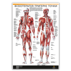 Плакат "Фізіотерапія-тригерні точки" Медіспорт 60 см х 84 см (1 плакат)