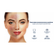 Вакуумний очисник шкіри та пор Medica+ Skincleaner 7.0