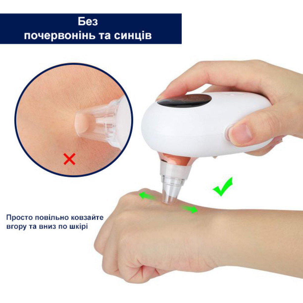 Вакуумний очисник шкіри та пор Medica+ Skincleaner 7.0