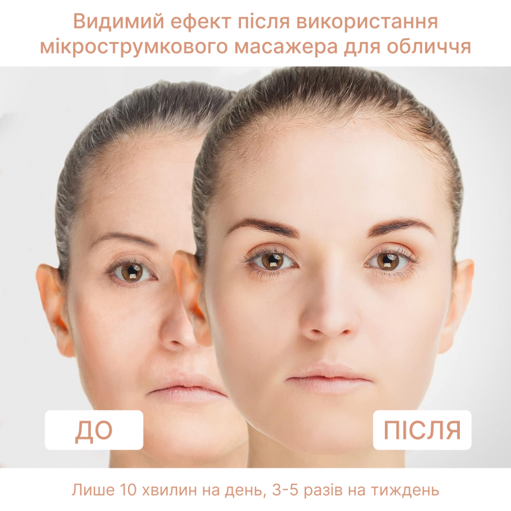 EMS мікроток ліфтинг-масажер для обличчя Medica+ Skin Lifting 6.0 White