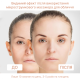 EMS мікроток ліфтинг-масажер для обличчя Medica+ Skin Lifting 6.0 White