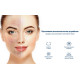 Ультразвуковий скрабер для обличчя Medica+ Vibroskin 5.0