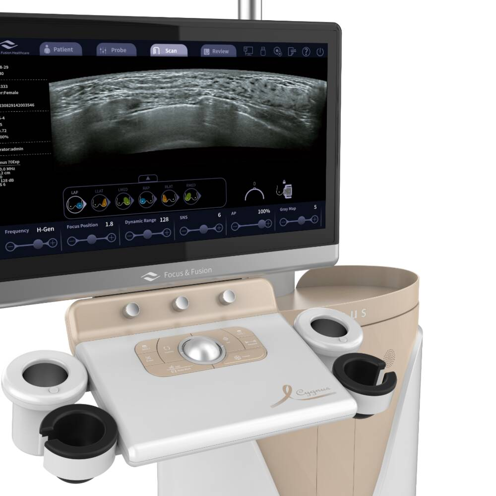 Автоматизована 3D-система ультразвукової діагностики молочних залоз Focus & Fusion Cygnus 70