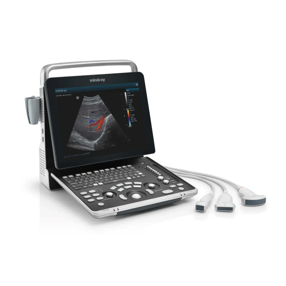 Cистема ультразвукова діагностична Mindray Z60