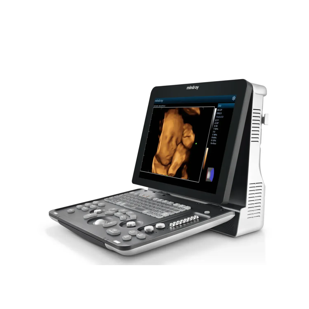 Cистема ультразвукова діагностична Mindray Z60