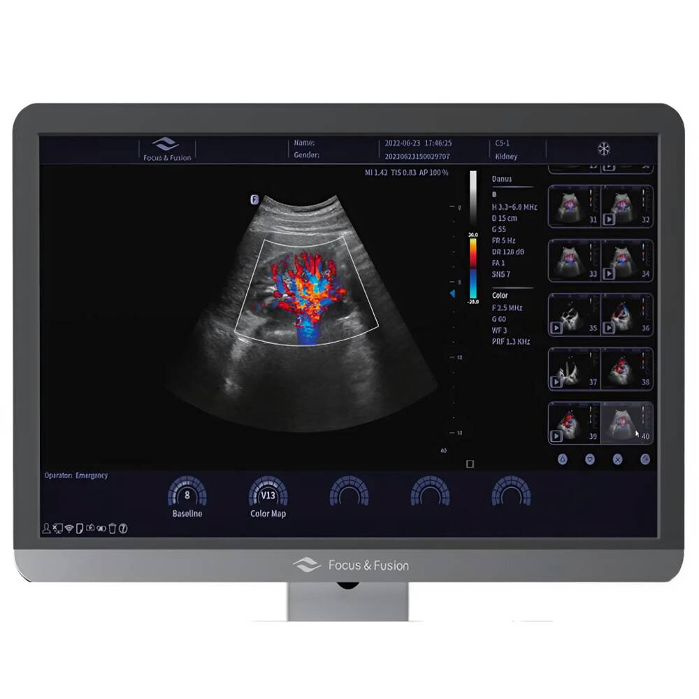 Ультразвукова діагностична система стаціонарна середнього класу Focus & Fusion Danus 8